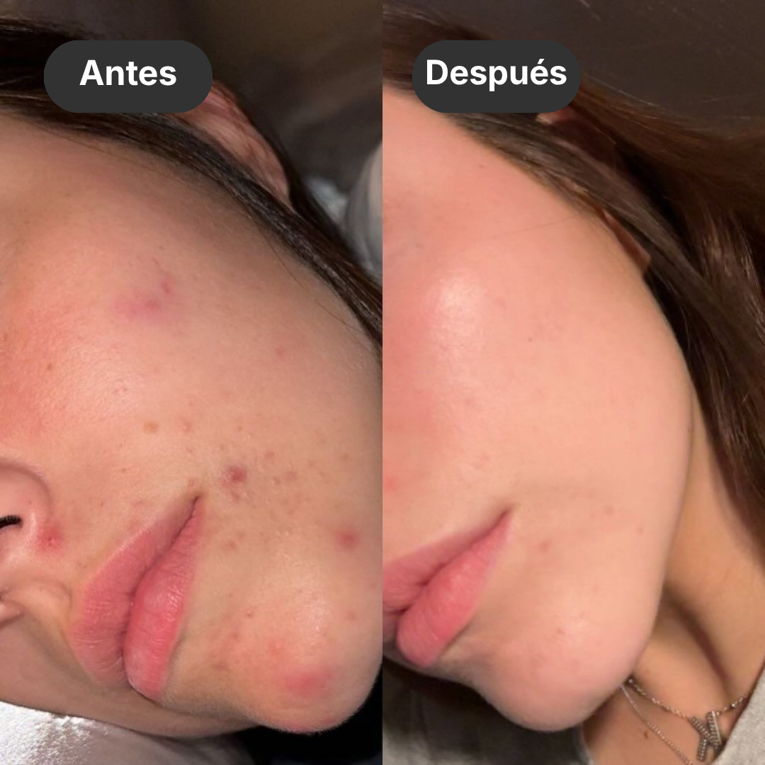 Noreva®  Esencia iluminadora efecto piel porcelana